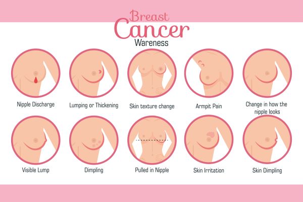 Image above shows the symptoms of breast cancer. Breast self-examination is important to detect any signs of breast cancer.